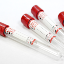Пробирки вакуумные для забора крови на гепатит